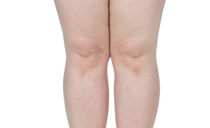 Pernas femininas em posição reta com calcinha preta, fundo branco.