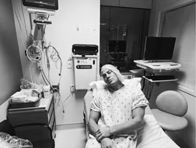 Separação do ombro: entenda condição que fez Channing Tatum passar por cirurgia